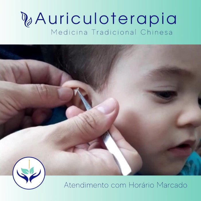 Tratamento de Auriculoterapia Clinica Bem Estar e Saúde